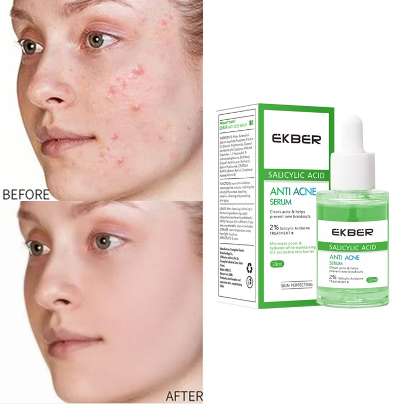 2022 New Arrival Korean Best Selling Facial 2% Salicylic Acid Anti Acne Serum Skin Care Anti Acne Serum