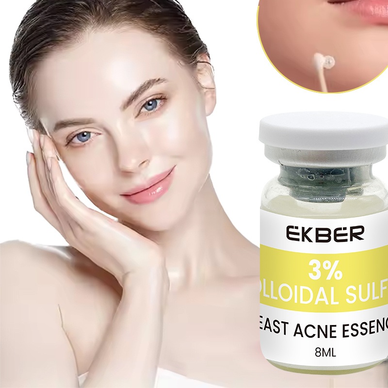 Wholesale Organic Skin Care Private Label Colloidal Sulfur Yeast Pox Clearing Serum Custom Serum for Acne