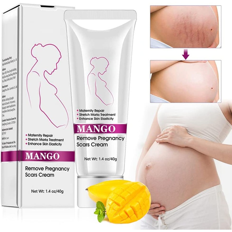 Wholesale Scar Post-Natal and Pregnancy Lines Repair Cream
