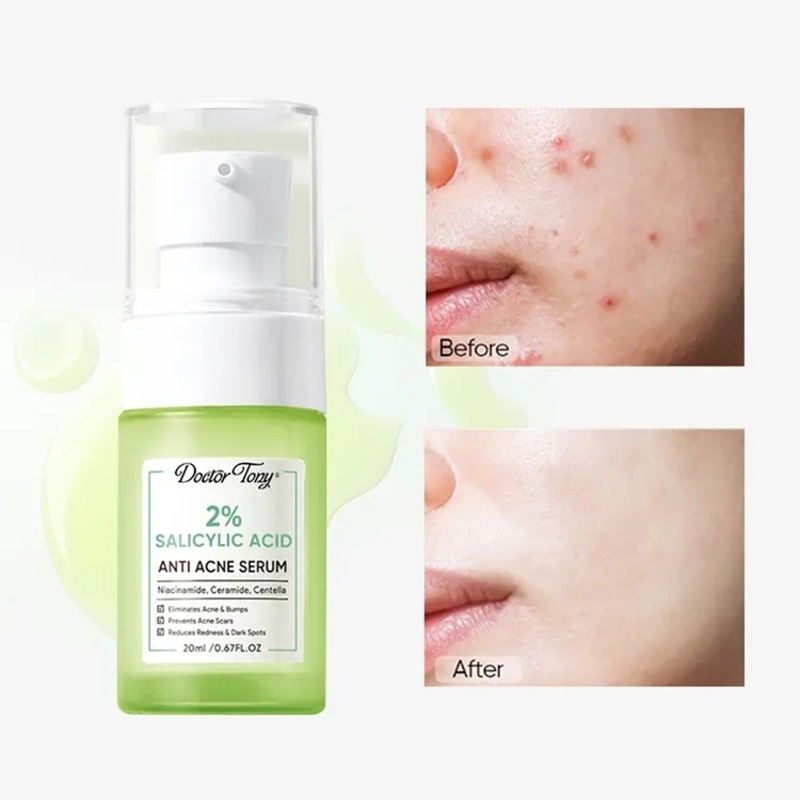 Wholesale 2% Salicylic Acid Exfoliating Repair Face Serum Anti Acne Treatment Skin Care Private Label Serum for Oily Skin