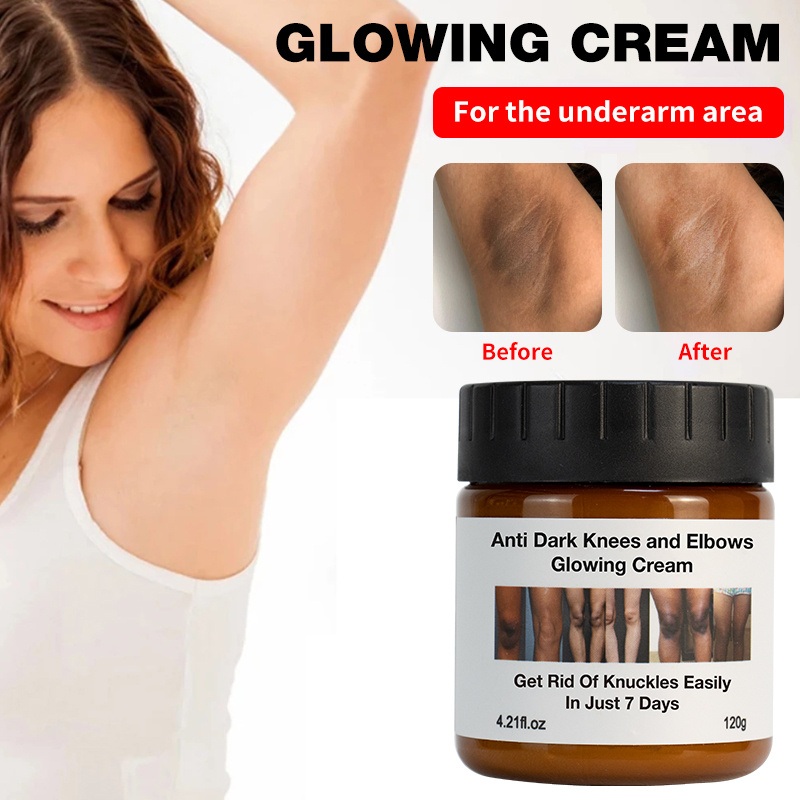 Anti Dark Spot Lighten Skin Complexions Knees Elbows Moisturizer Body Whitening Cream