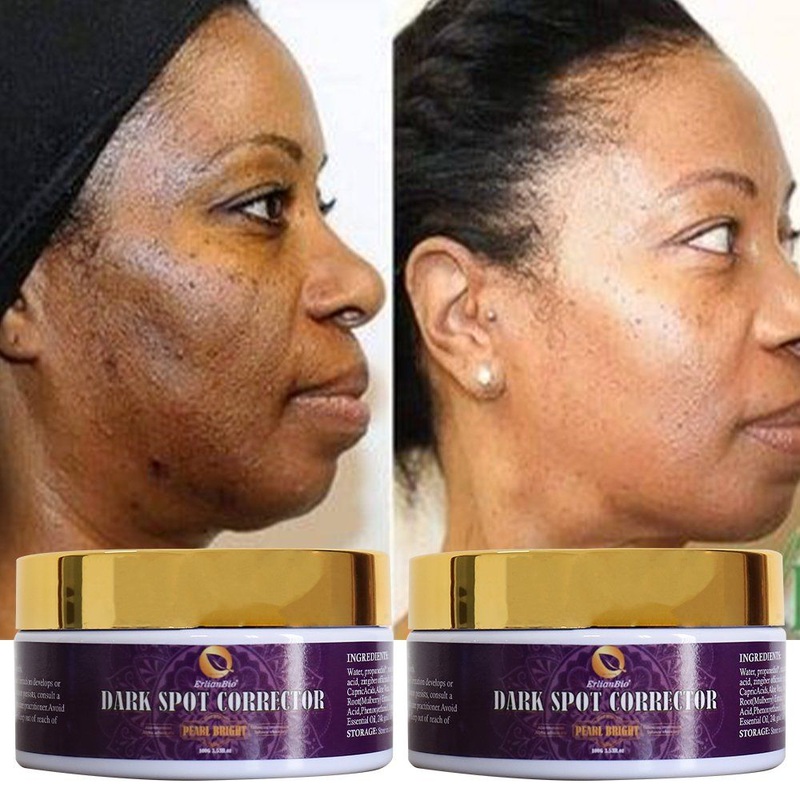 Whitening Hydrating Dark Spot Removal Face Cream Glutathione Collagen Brighten Anti Acne Skin Cream