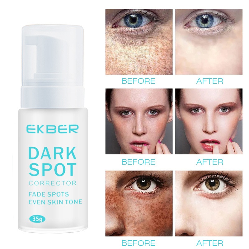 35g Organic Skin Whitening Anti Freckle Face Cream for Pigment Melasma Acne Pimples Dark Spot Removal Cream