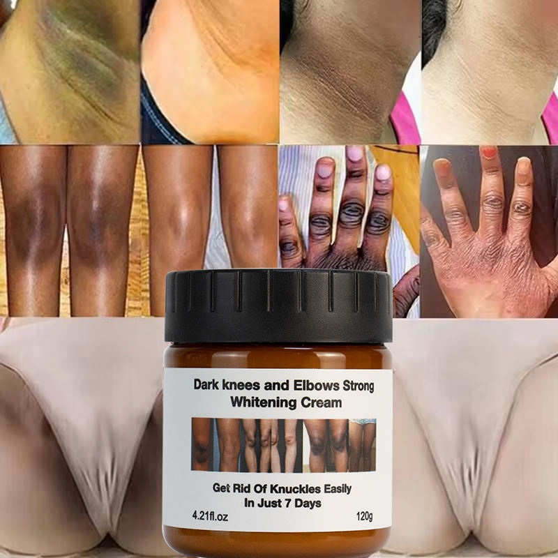 Wholesale Body Care Skin Whitening Creams Anti Dark Spot Wrinkle Knees Elbows White Lotion Moisturizer Body Whitening Cream