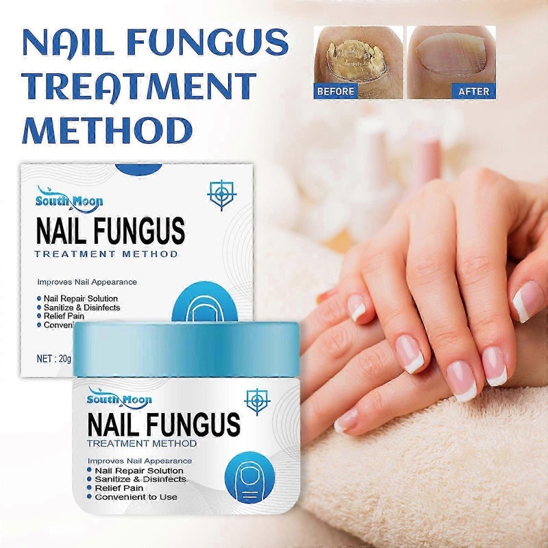 South Moon Nail Repair Cream for Repairing Gray Nails, Brightening Nails, Thickening Nails, Hands, Feet, Nails, Moisturizing Care Cream