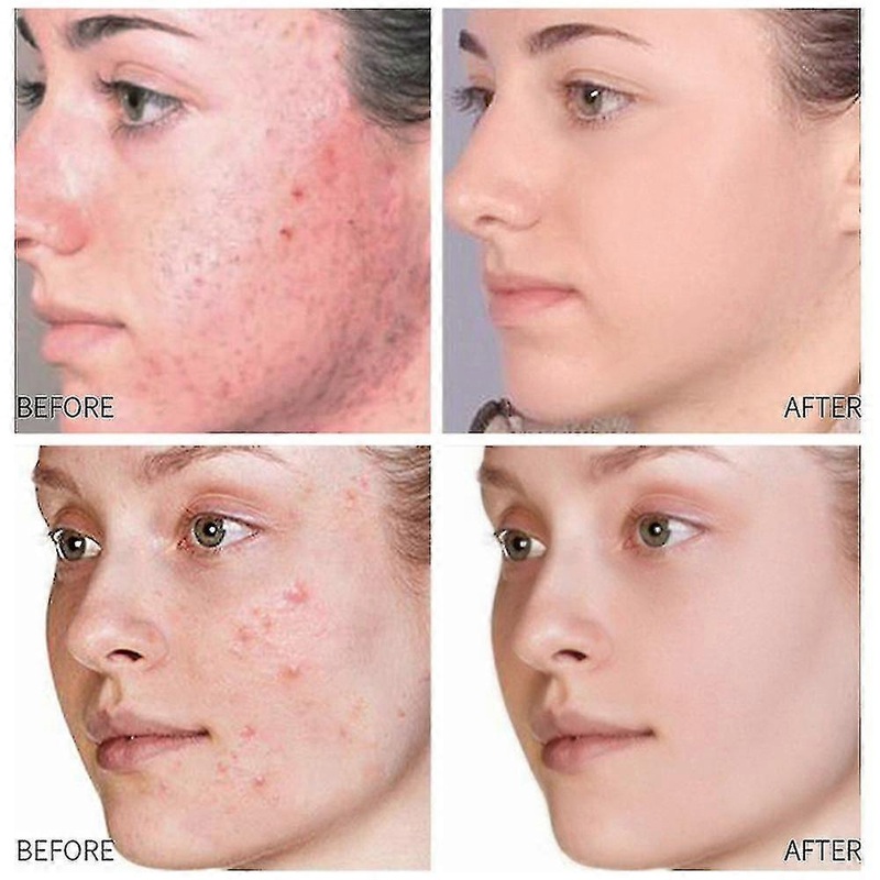 Face Serum 30ml Retinol Collagen Vitamin C Hyaluronic Acid Anti-aging