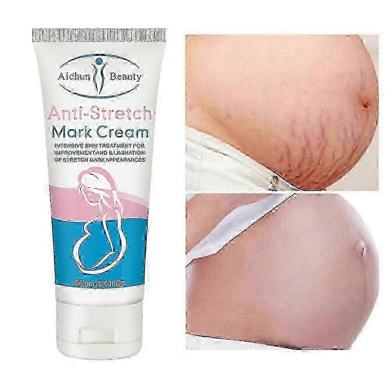 Snail Removes Stretch Mark Cream To Remove Postpartum Obesity Pregnant Women Repair Anti-Aging Anti-Winkles Firming Body Cream