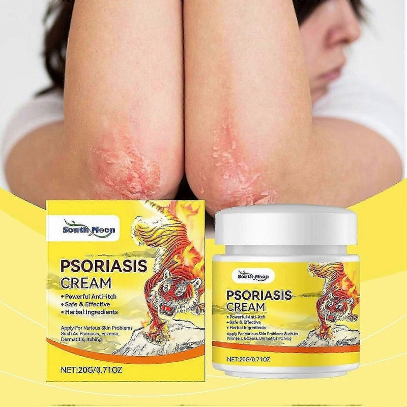 Herbal Psoriasis & Eczema Relief Cream Anti-Itch, Soothing & Moisturizing with Allantoin & Natural Extracts for Sensitive Skin