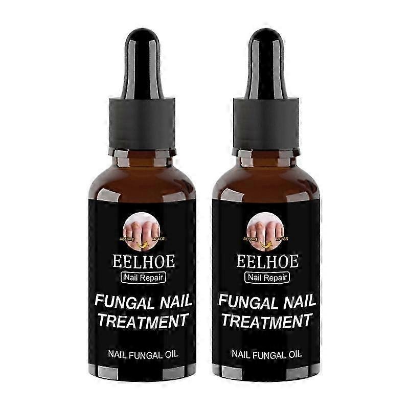 2-Piece Nail Fungal Treatment Kit with Antibacterial Formula for Toe and Finger Infections