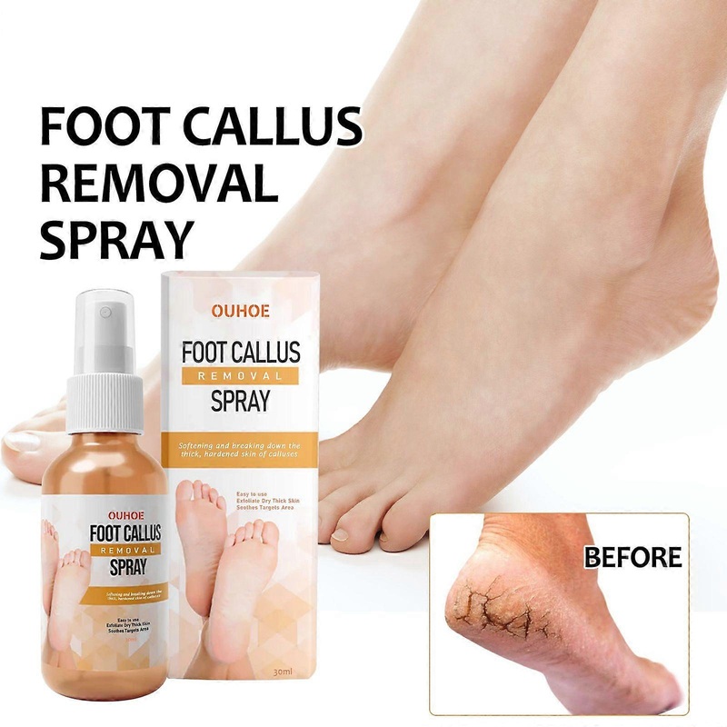 Foot Callus Removal Spray, Foot Peeling Spray, Foot Spray for Dry Cracked Feet, Foot Exfoliating Spray Remove Dead Skin from Feet, Foot Softener Hydra