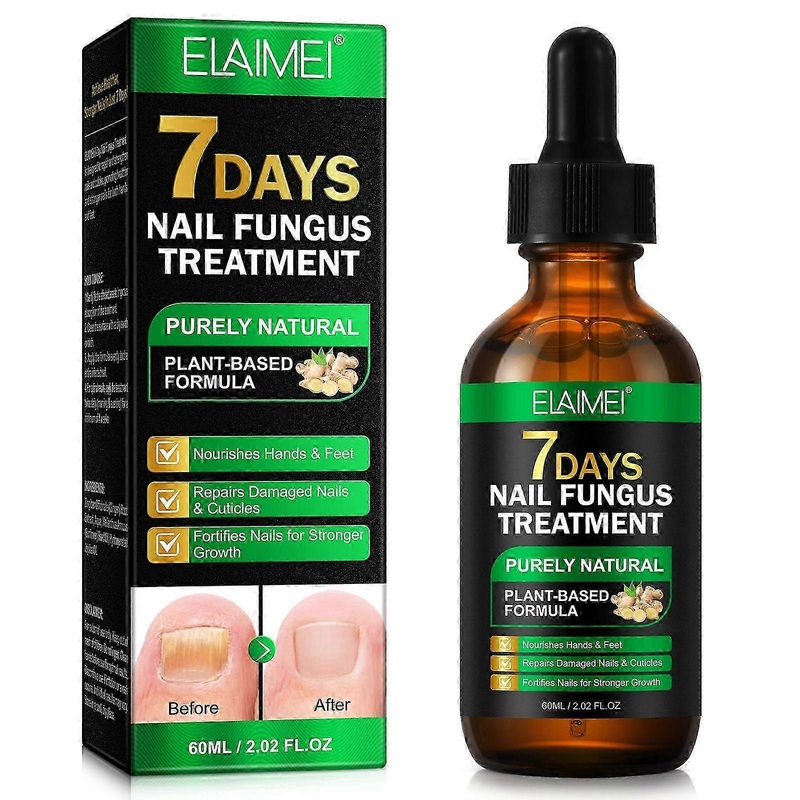 2025 Nail Fungus Treatment, Ginger Nail Fungus Treatment, Toenail Cuticle Care Oil Care, Fungal Nail Treatment, 7 Days Nail Fungus Treatment for Toena