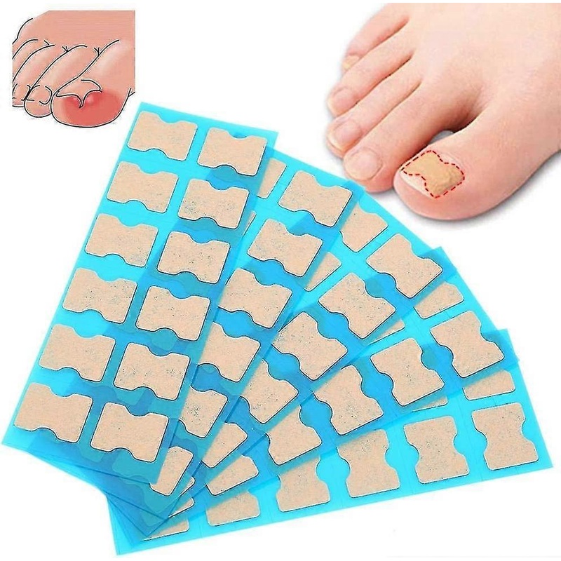 Toe Nail Correction File Patch - Ingrown Toenail Stick Patch, Paronychia Solution