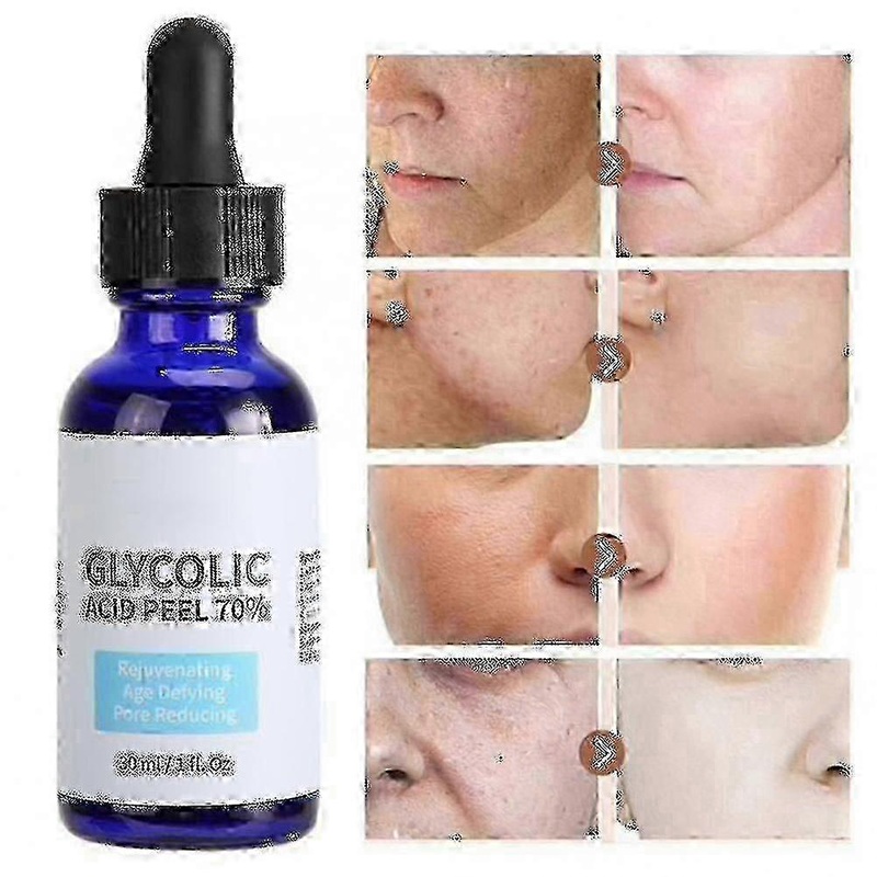 2025 Glycolic Acid Peel Purity 70% Concentration 5% Skin Repair Invisible Pores Brighten Skin Tone Treat Acne Mild And Non-irritating