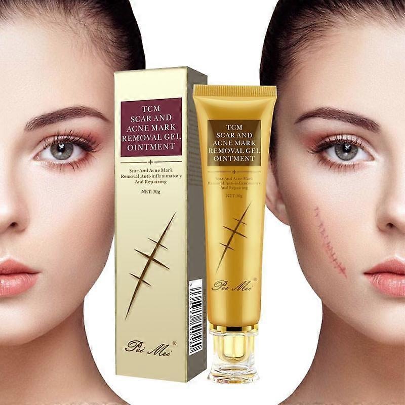 Repair Cream Remove Scars And Stretch Marks Light Absorbed Quickly Easy To Apply Pigmentation Corrector Skin Care TSLM1