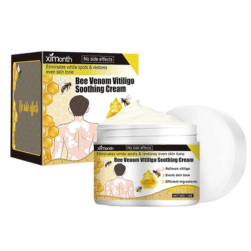vitiligo treatment cream portable anti-itch body care