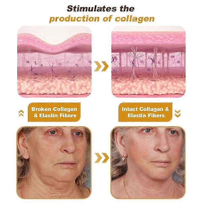 Suitable for 2/3/5PCS Bee Venom Wrinkle Removal Anti-Aging Cream-JC