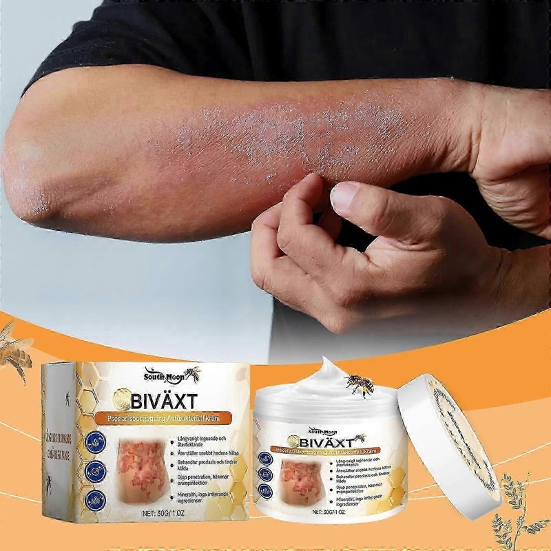 Bees-venom Psoriasises Cream Anti-itch Skin Relief Cream Skin Care Products
