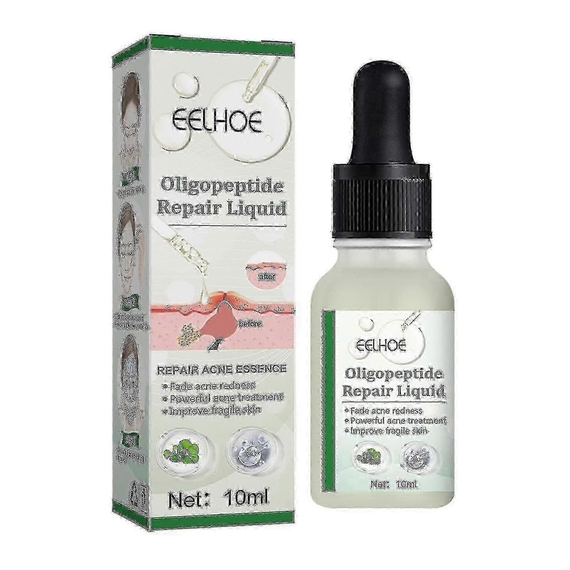 Eelhoe Oligopeptide Repairing And340 -4090862038774