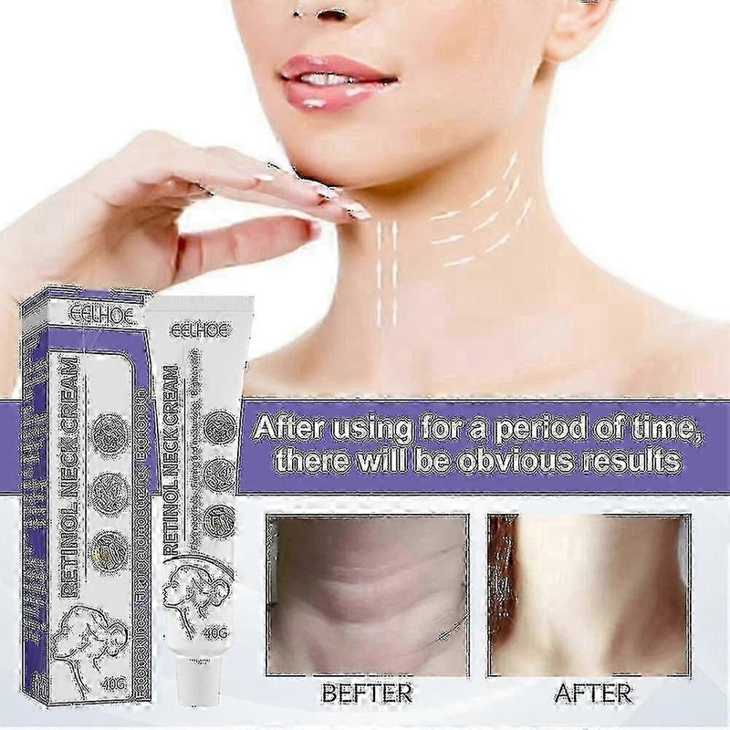 1 Pc Retinol Neck Cream Anti-aging Firming Skin Whitening Anti-wrinkle Cream -4156607400845