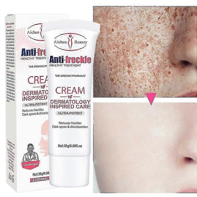 New whitening freckle cream removes dark spots anti-aging skin care cosmetics