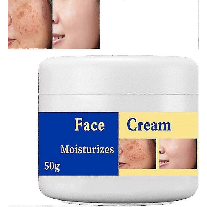 Whitening Freckle Cream,Skin Brightening Cream,Moisturizing Anti-Blemish