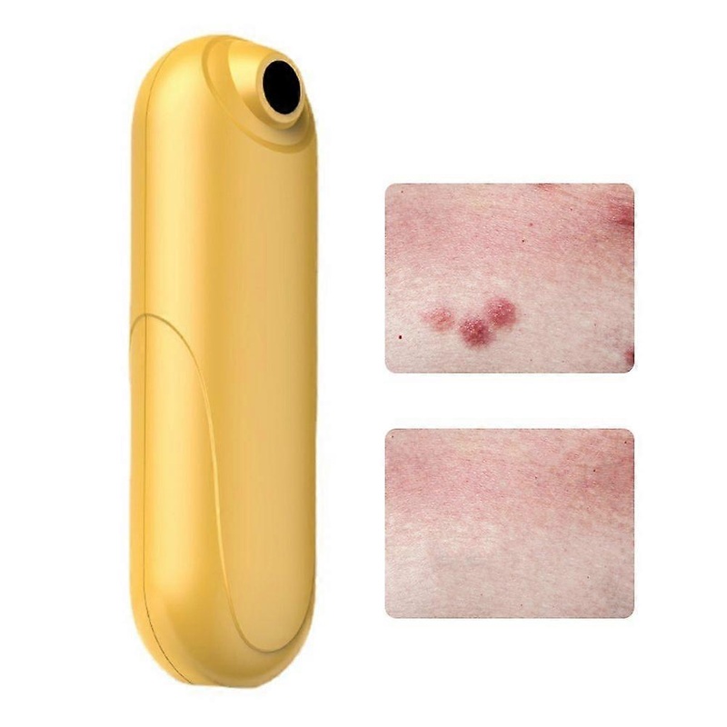 Bug Bite Itch Relief Tool USB Rechargeable Mosquito Bite Sucker Chemical Free for Bug Bites Bee Wasp Stings