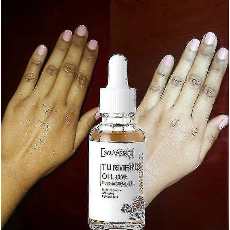 Turmeric Oil Face Whitening Serum Lightening Acne Dark Patches Anti-aging Bright Skin Acne Dark Spot Corrector Skin Care
