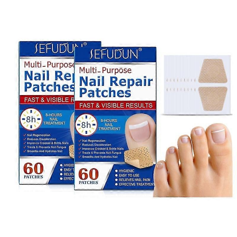 WJTG  SEFUDUN Nail Repair Patch Embedded Toenail Corrector Toenail Patch 60 Pieces 1J