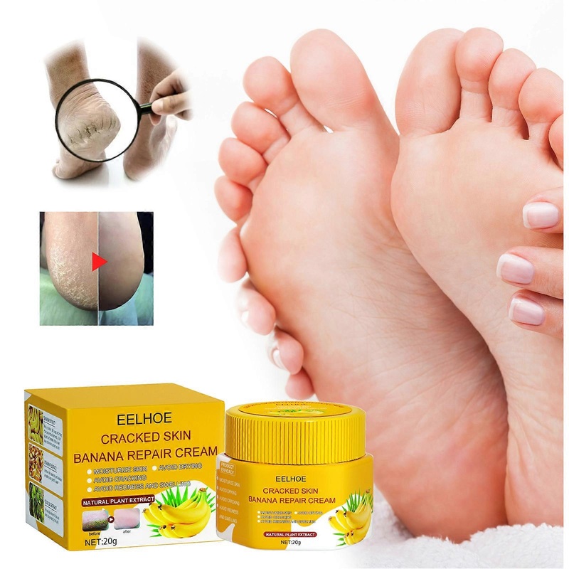 Cracked skin banana repair cream foot care anti-cracking anti-freeze hand and foot care repair cream