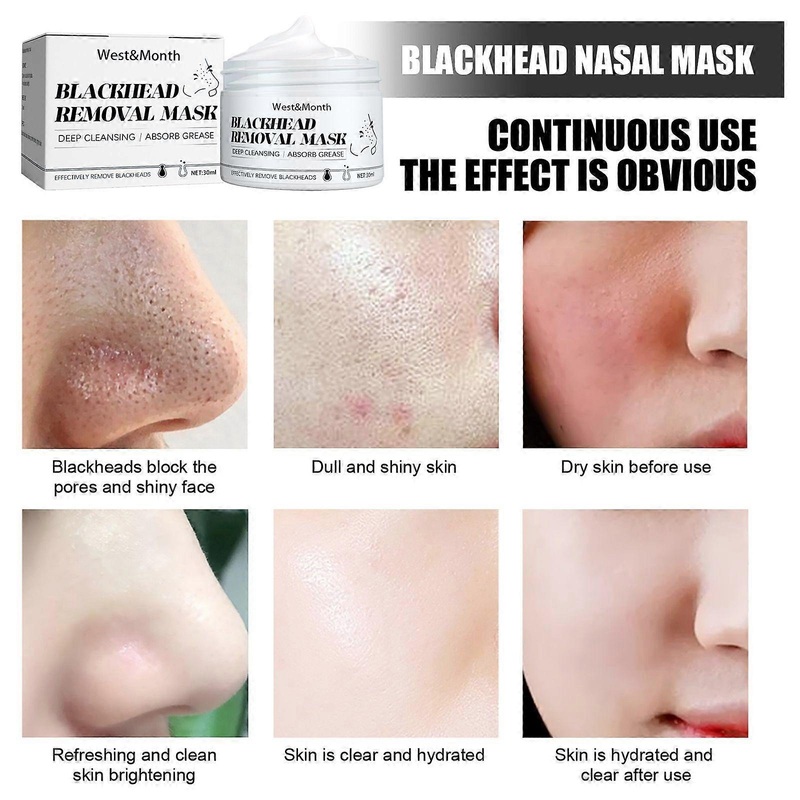 3 Sets Blackhead Remover Mask With 60pcs Strips, Remove Black Heads Face Black Head Remover