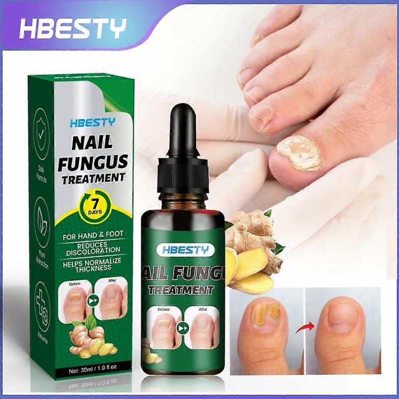 Toenail Fungus Treatment Extra Strength, Ginger Nail Treatment Nail Support Nail Care, 7 Days Nail Treatment, Nail Nutrient Strengthener Ginger Nail G