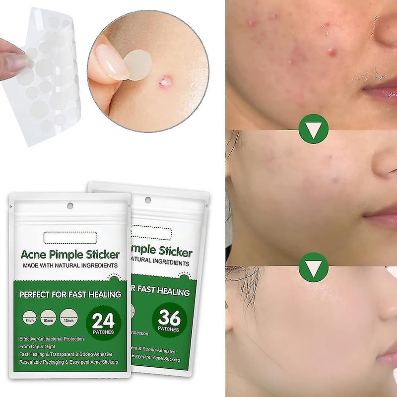 Acne Pimple Patch,invisible Hydrocolloid Acne Patch For Blemishes And Zits Cover, Spot Stickers For Face And Body
