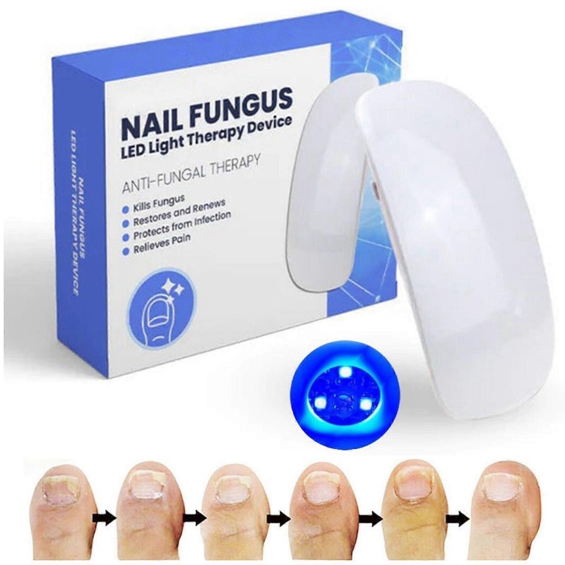 Nail Fungus Laser-Device Light Therapy Onychomycosis Toes Treatment Home,100% New