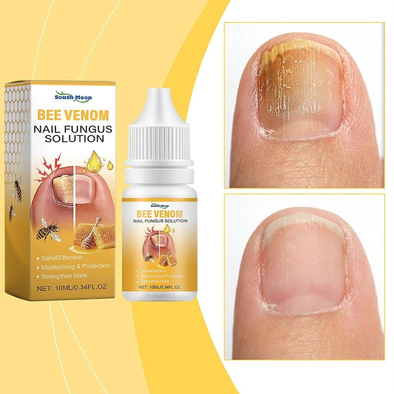 Bee Venom Nail Fungus Solution, Bee Venom Toenail Fungus Treatment Extra Strength, Ingrown Toenail Treatment Nail Care Oils